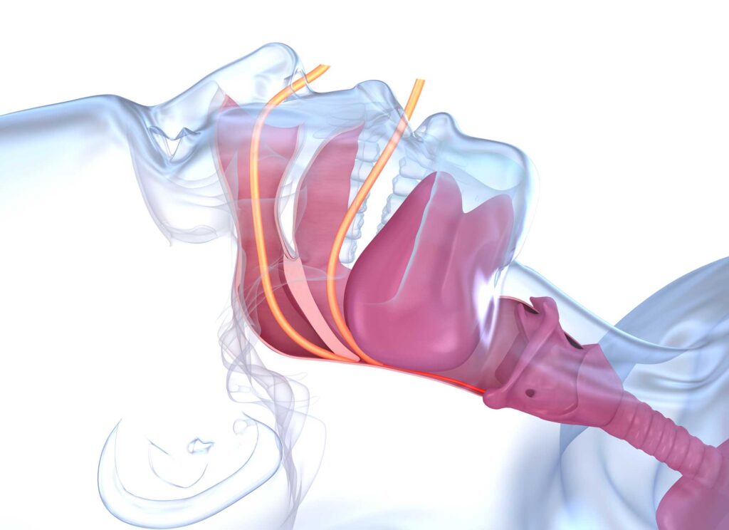 Odontoiatria del sonno anatomia